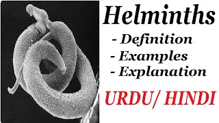 Definition and Examples of Helminths Types of Parasite Urdu  Hindi [upl. by O'Carroll754]