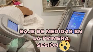 BAJA MEDIDAS EN LA PRIMERA SESION DE CRIOLIPOLISIS ANTES Y DESPUES   LIPO SIN BISTURI  ORIGIMENEZ [upl. by Allevon]