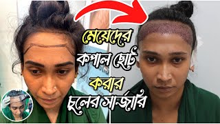 মেয়েদের কপাল ছোট করার হেয়ার ট্রান্সপ্লান্ট  Women Hair Transplant Bangladesh [upl. by Yrrab]