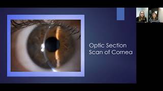 Lecture Using the Slit Lamp Microscope to Visualize the Ocular Structures [upl. by Chadwick]