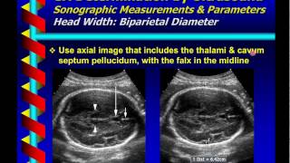 Gestational Age Determination by Ultrasound [upl. by Katrinka]