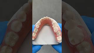 Lower TCS Unbreakable FiberFlex Partial EnvisiontecMain tcsdentalinc envisiontectcsdentalinc [upl. by Agler]