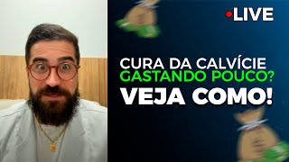 A CURA da calvície sem gastar muito [upl. by Neysa]