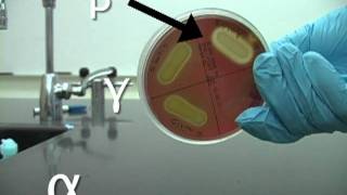 Identifying hemolysis [upl. by Pauwles]