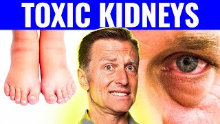 7 Warning Signs That Your Kidneys Are Toxic [upl. by Gilboa]