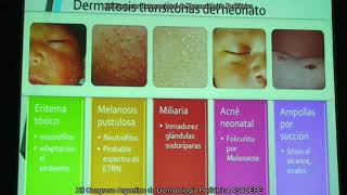 DIAGNÓSTICO DIFERENCIAL DE LESIONES AMPOLLOSAS EN EL RECIÉN NACIDO ECOS DEL CONGRESO 207 [upl. by Artemis896]