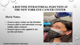 Eye Cancer Specialist New Intravitreal Injection Methods [upl. by Ahtebbat]