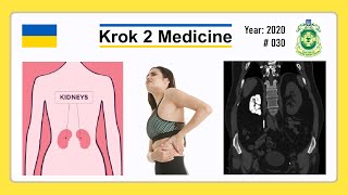 Krok 2 Medicine  Year 2020  030 Ministry of Public Health of Ukraine [upl. by Nitsirt658]