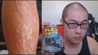 Is FLEX TAPE strong enough for Psoriasis Flakes [upl. by Annuahsal119]