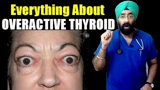 Rx Thyroid 4 Eng All About Overactive THYROID  Hyperthyroidism  DrEducation [upl. by Manaker724]