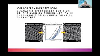 Anatomie des 5 muscles du cou Partie 1 [upl. by Greenstein811]