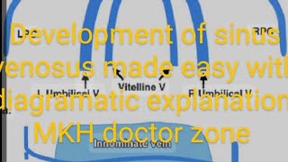 CV A 006Development of sinus venosus in easy way CVS embryology [upl. by Derron]