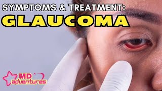 Glaucoma Symptoms and Treatment 👁️ [upl. by Herries59]