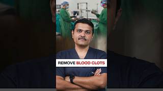 Remove BLOOD CLOTS without Surgery vascularsurgery shortsvideo thrombosis [upl. by Ramsa]