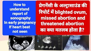 blighted ovum Incomplete or missed abortion का ultrasound रिपोर्ट मे क्या मतलब होता है [upl. by Llehsor178]