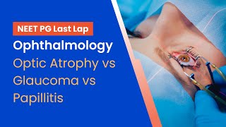 NEETPG Prep  Ophthalmology  Optic Atrophy vs Glaucoma vs Papillitis by Dr Vineet Sehgal [upl. by Aileduab]