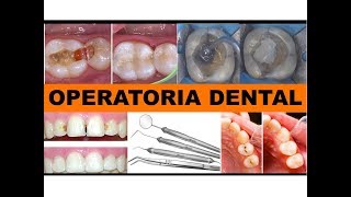 quotOPERATORIA DENTALquot por la Dra Lourdes Mejía 2 [upl. by Maurine]