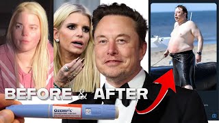 Ozempic Celebrities  BEFORE amp AFTER  Elon Musk Kelly Clarkson Jessica Simpson and MORE [upl. by Home]