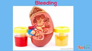 Kidney Biopsy Informational Video [upl. by Annoled]