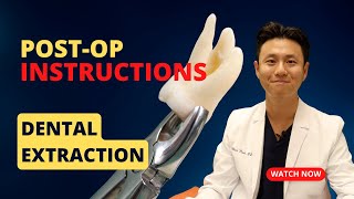 EXTRACTION  Postop Instructions  MUST WATCH AFTER DENTAL EXTRACTION [upl. by Pierrepont966]