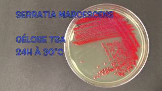 Serratia marcescens [upl. by Mauretta]