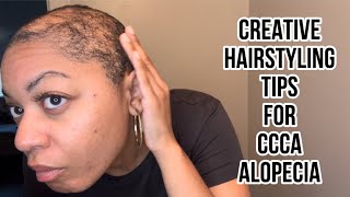 Creative Hair Styling Tips for Alopecia 😍🧑🏽‍🦲 alopecia ccca confidence [upl. by Rainwater]