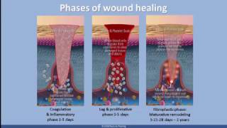 Understanding Scar Tissue [upl. by Isbella]