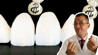 QUANTO CUSTA LENTE DE CONTATO DENTAL ou FACETA A Verdade em 1 min [upl. by Shinberg]