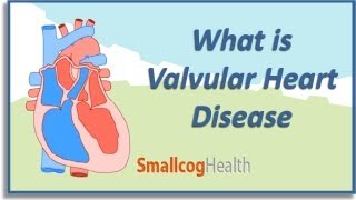 What is Valvular Heart Disease [upl. by Sublett758]