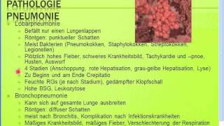 Gratis Seminar Pneumonien  Typische  atypische Pneumonien [upl. by Uol]