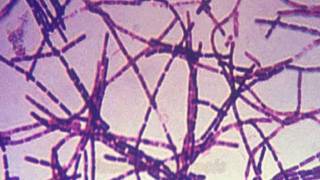 Anthrax and Bacillus anthracis [upl. by Longtin]