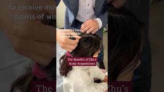 The Benefits of Zhu’s Scalp Acupuncture [upl. by Ailed467]