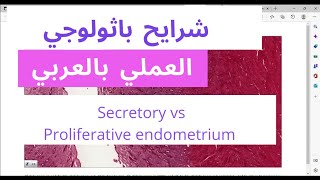 Secretory phase vs Proliferative phase endometrium  histology slide review [upl. by Tenom]