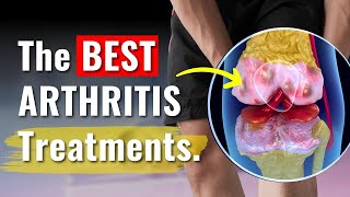 Knee Arthritis Treatments Proven to Work  The Truth You Need to Know [upl. by Enaasiali]