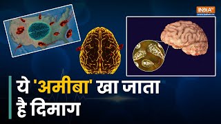 Primary amebic meningoencephalitis  तैरने गए बच्चे का दिमाग खा गया Amoeba  Brain Eating Amoeba [upl. by Kendal]