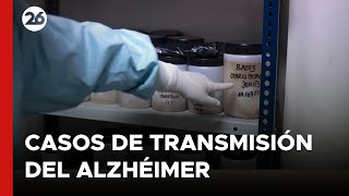 REINO UNIDO  Presuntos primeros casos de transmisión del Alzhéimer [upl. by Suiramed]