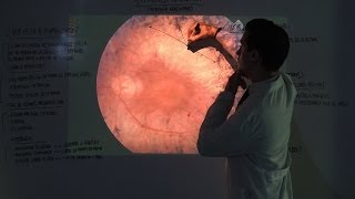 Retinosis Pigmentaria  Tipos y Tratamiento  Patología Ocular [upl. by So296]