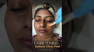 Laser Toning Instant Glow Peel at Asthederm Aesthetics by Jasmine [upl. by Ainelec]