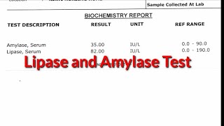 Lipase and Amylase test pancreatitis Pathology pathology bloodisorder [upl. by Acisseg]