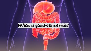 What is gastroenteritis  About gastroenteritis  gastroenteritis  gastroenteritis problem [upl. by Cowles]