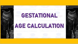 How to Measure Gestational Age with the Help of Multiple Ultrasound Parameters [upl. by Ecaroh]