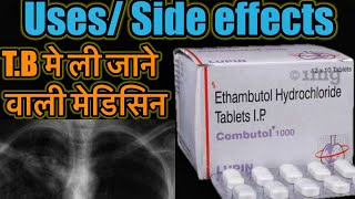 Combutol Tablet  Ethambutol Hydrochloride Tablet  TB ki Dawa  TB Medicine  Dose Side Effects [upl. by Colvin405]