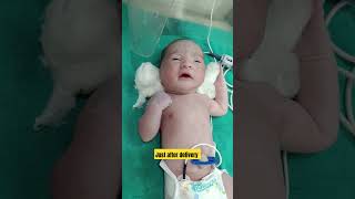 Newborn baby gruntingjust after delivery nicu icu baby cutebaby exercise cute [upl. by Adlih]