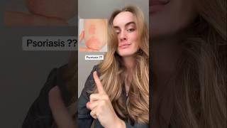 4 PROBS 4 SOLUTIONS ✅ skincare skincaretips [upl. by Ahtiek536]