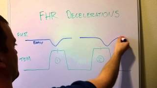 Fetal Heart Rate Decelerations Early Late Variable [upl. by Capone]