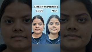 What is Microblading eyebrows  Eyebrow tattoo microblading Microblading eyebrows before and after [upl. by Homer]