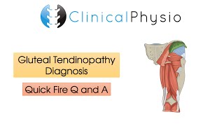 Classic Gluteal Tendinopathy Diagnosis  Clinical Physio [upl. by Tserrof320]