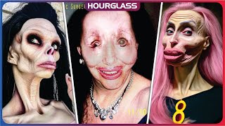 30 Celebrity Plastic Surgery Disasters  You’d Never Recognize Today [upl. by Idok]