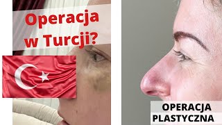 VLOG Operacja plastyczna nosa w Turcji  Eva w Turcji [upl. by Ireg]