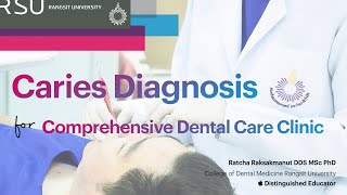 Caries Diagnosis for RSU Comprehensive Care Clinic Updated 2023 [upl. by Igenia]